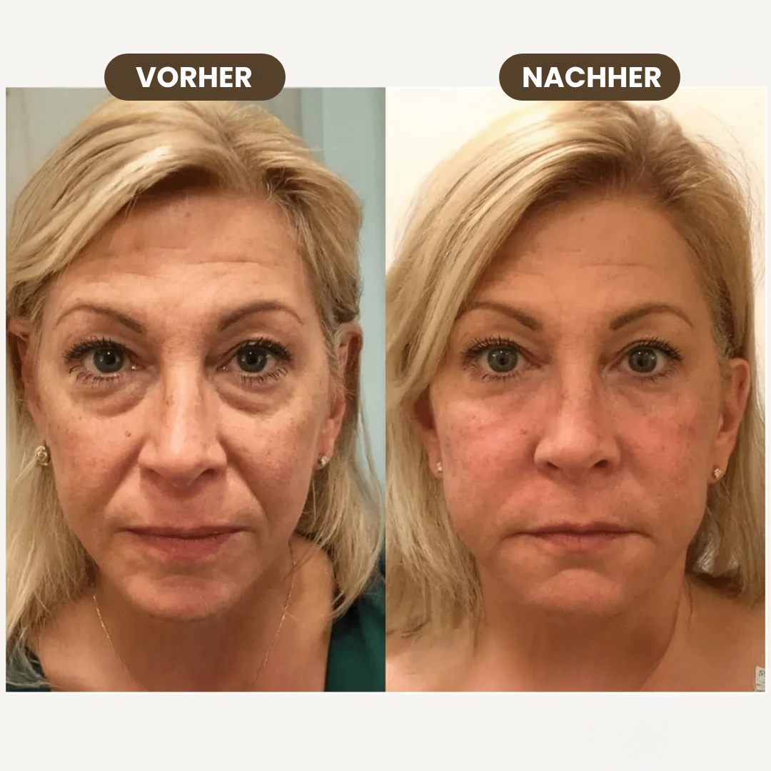 Glowiapro™ Prämie-Lymphdrainage-Bürste