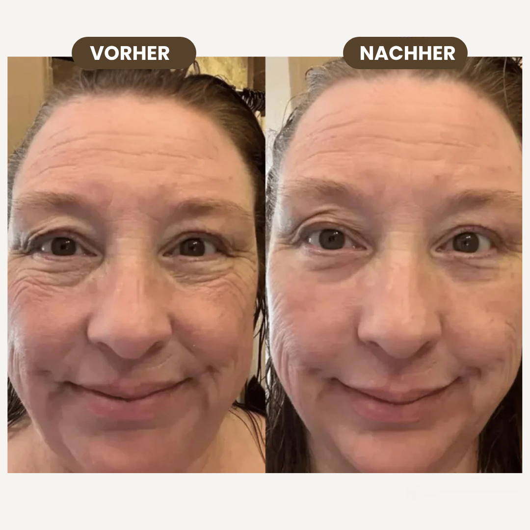 Glowiapro™ Prämie-Lymphdrainage-Bürste